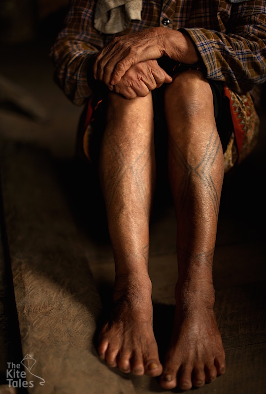 ဒေါ်မာကွေလိုင်းညူ၏ ခြေထောက်မှ ဆေးမှင်ကြောင်များ